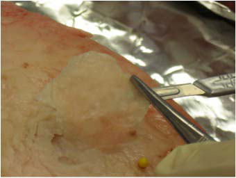 2009-evaluation-of-escherichia-coli-translocation-figure-02