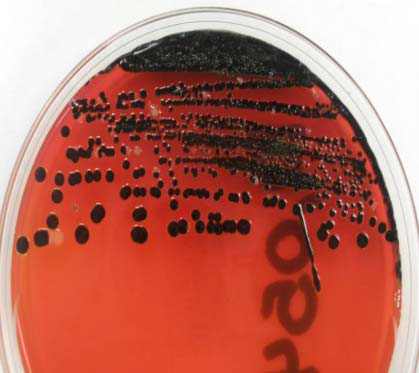 2009-vaccine-potential-for-salmonella-in-dairy-cattle-figure-02