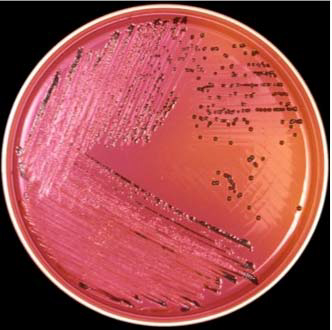 2011-characterization-of-salmonella-figure-02