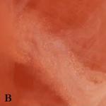 PQ_ProjectSummaries-2012-Skeletal-Muscle-Differentially-Influences-Marbling-Development-Figure-02