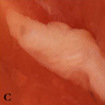 PQ_ProjectSummaries-2012-Skeletal-Muscle-Differentially-Influences-Marbling-Development-Figure-03